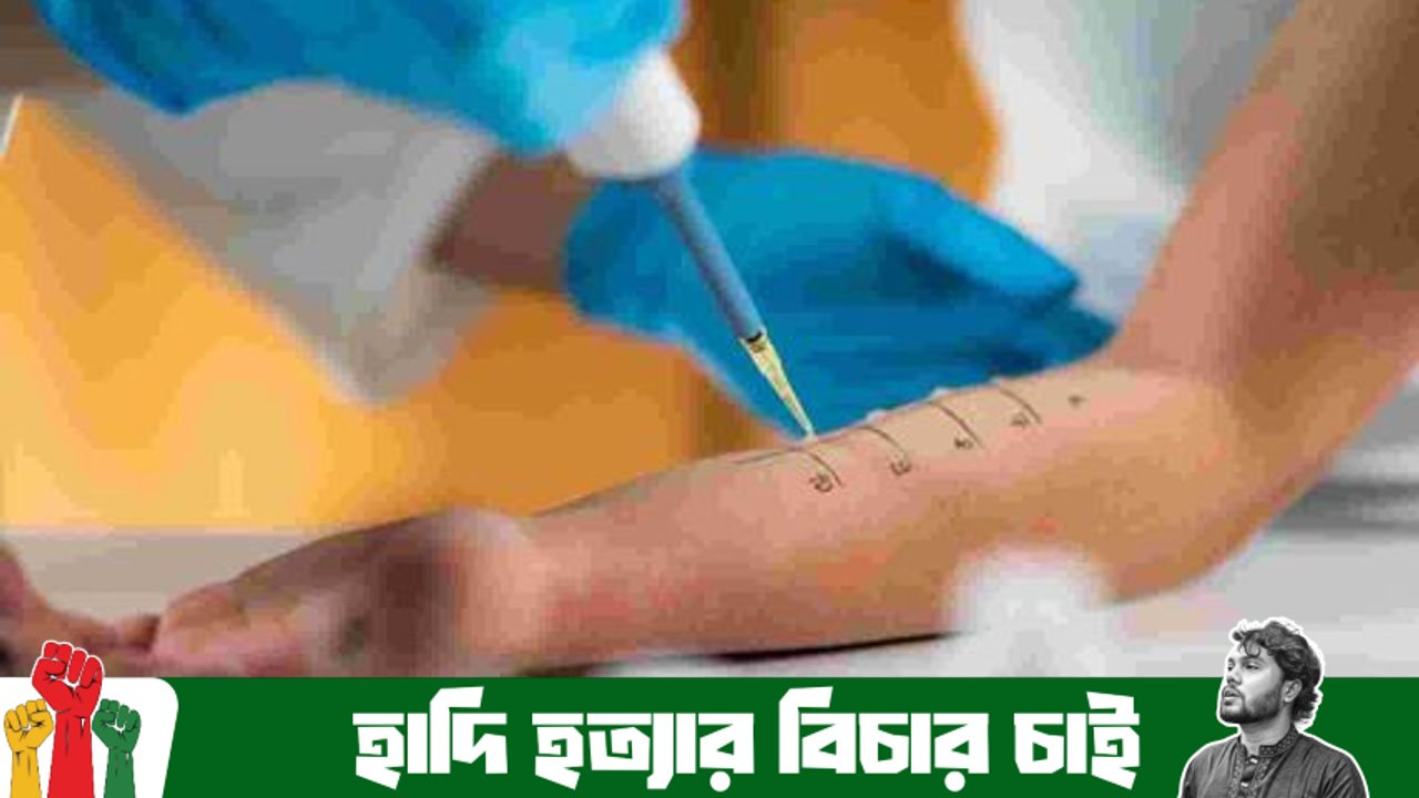 বাংলাদেশে এলার্জি রোগী কেন বাড়ছে? এলার্জি নিয়ন্ত্রণে রাখার কার্যকর উপায়